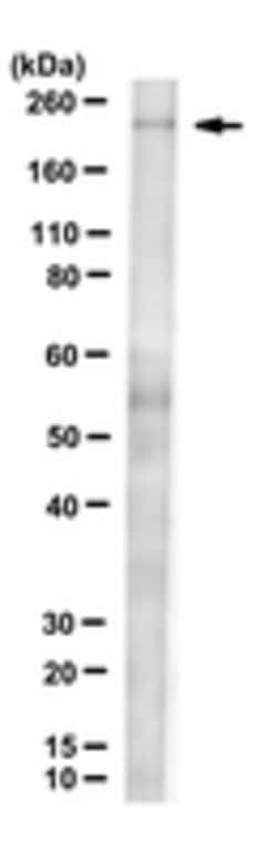 Myosin 7 (MYH7) Rat anti-Mouse, Clone: 4B51E8, MilliporeSigma:Antibodies:Primary